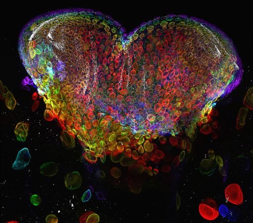 eye-organ-fruit-fly-macro-world-2012 eye-organ-fruit-fly-macro-world-2012