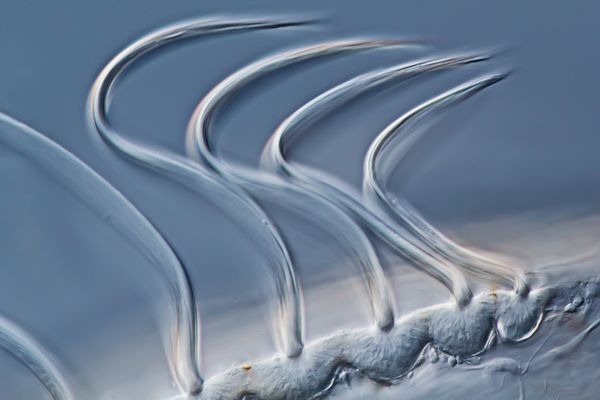 sea-gooseberry-macro-world-2012 sea-gooseberry-macro-world-2012